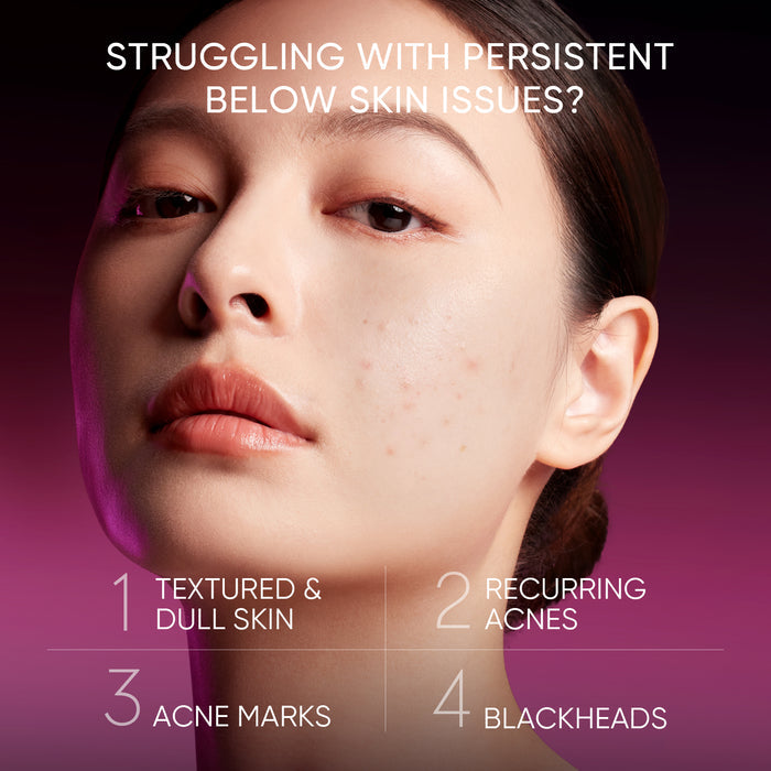 Skintific 2% AHA BHA PHA LHA Peeling Solution 30ml
