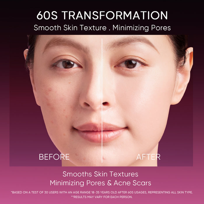 Skintific 2% AHA BHA PHA LHA Peeling Solution 30ml