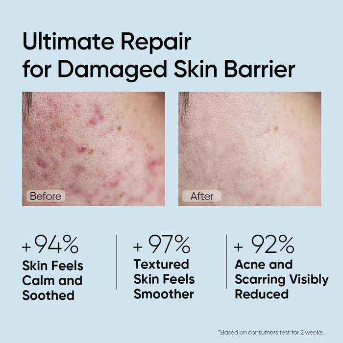 Skintific 5X Ceramide Skin Barrier Repair Serum 50ml