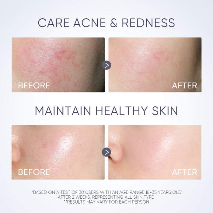 Skintific Truffle Biome Skin Reborn Cream Gel Moisturiser 50g
