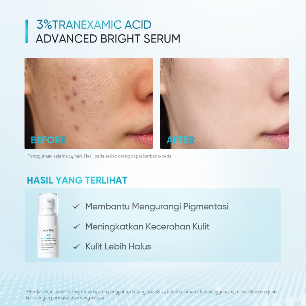 Skintific 3% Tranexamic Acid Advanced Bright Serum 20ml